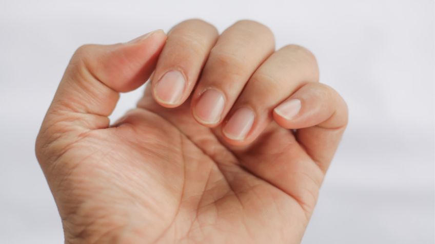 Uñas rojas: Secuela dejada por el coronavirus en pacientes asintomáticos