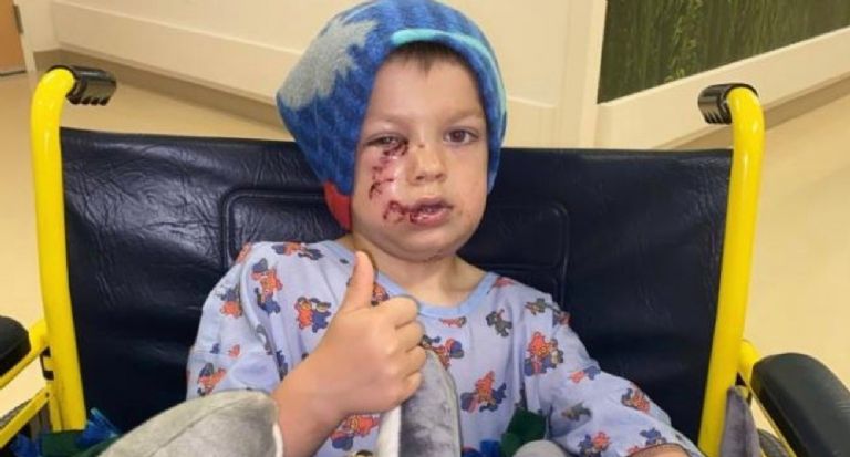 Liam Pruitt fue atacado por el perro de su niñera