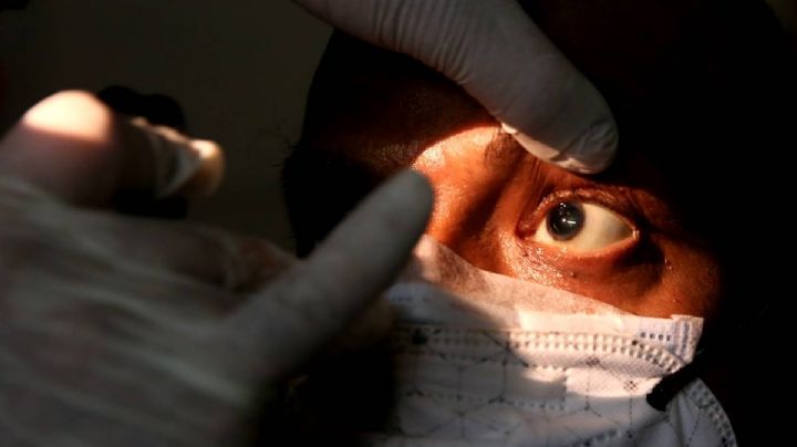 ¡Atención! IMSS niega que se presentara primer caso de 'hongo negro' en México