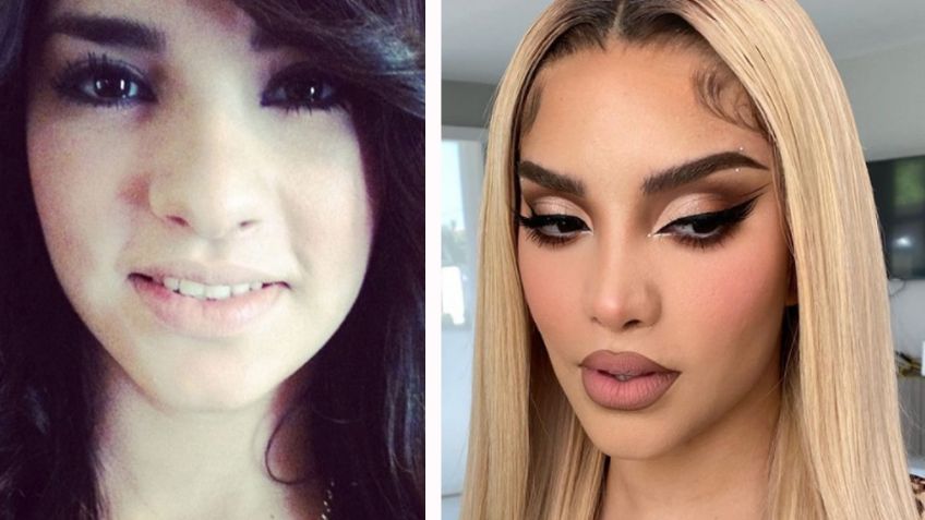 "¿Es travesti o Laura Bozzo?": Destrozan a Kimberly Loaiza tras lucir brutal cambio de rostro en PJ