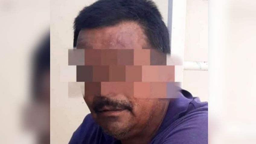 Hermosillo: Por tornarse violento, su familia lo sometió y lo entregó a la Policía