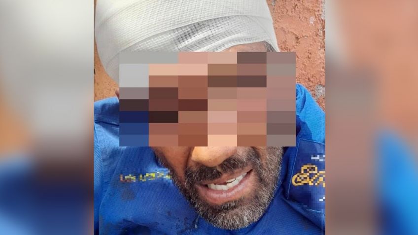 Ladrón sufre fuerte herida en la cabeza; lo sorprendieron dentro de casa ajena en Hermosillo