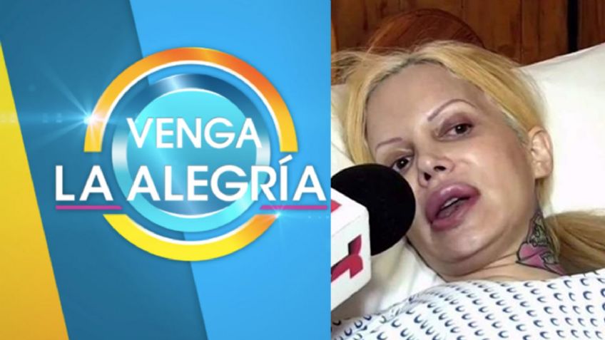 Adiós 'Hoy': Tras renunciar a Televisa y desfigurarse con cirugías, famosa actriz debuta en 'VLA'