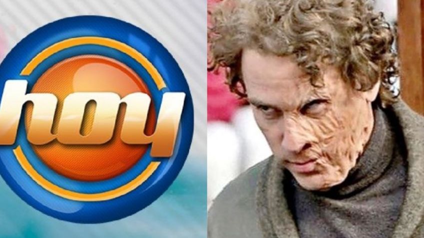 Tras acabar 'desfigurado' y dejar México, villano de Televisa vuelve a las novelas y llega a 'Hoy'