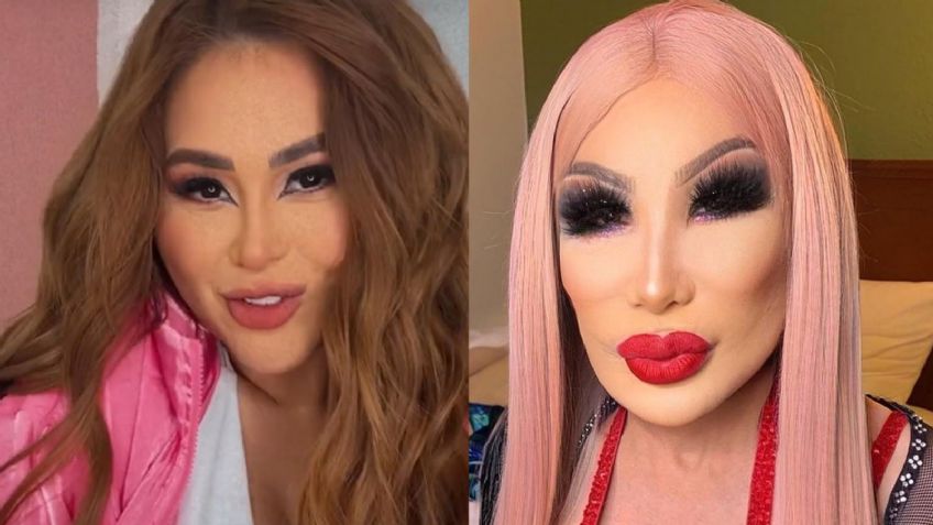 "La nueva Lyn May": 'Gomita' impacta a todo Instagram al reaparecer con rostro ¿desfigurado?