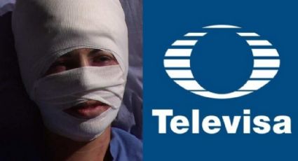 En la ruina y desfigurada: Tras 18 años desaparecida y veto de TV Azteca, actriz vuelve a Televisa