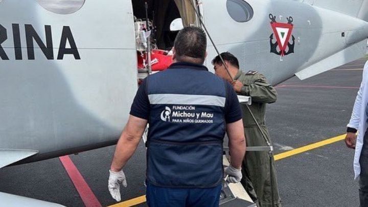 Menores con quemaduras son atendidos en el Estado de México y se recuperan