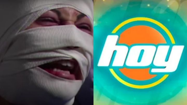 Desfigurada y en la ruina: Tras 18 años retirada de Televisa, exactriz de TV Azteca vuelve a 'Hoy'