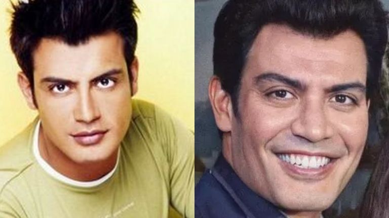 Aseguran que Andrés abusó del Botox