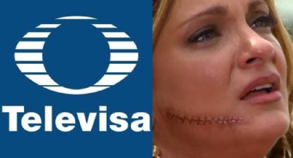 Adiós TV Azteca: Tras acabar desfigurada y llegar a 'VLA', actriz supera veto y vuelve a Televisa