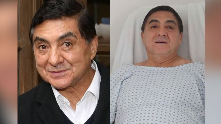 Carlos Bonavides revela que será sometido a una cirugía tras serios problemas de salud