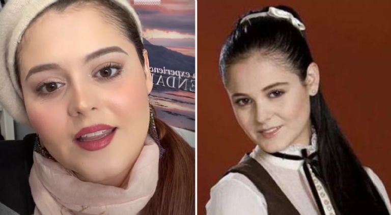 Allisson Lozz y su drástico cambio físico