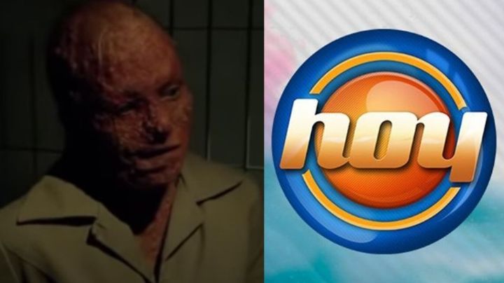 En la cárcel y desfigurada: Tras divorcio y 10 años retirada de Televisa, actriz aparece en 'Hoy'