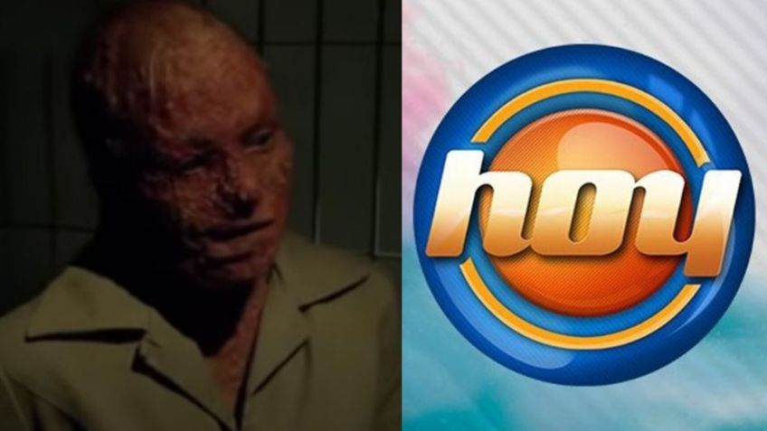 En la cárcel y desfigurada: Tras divorcio y 10 años retirada de Televisa, actriz aparece en 'Hoy'