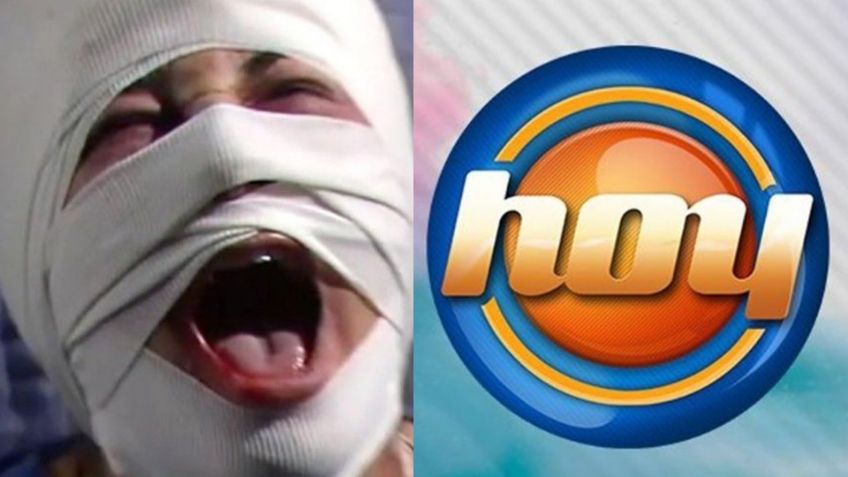 Adiós TV Azteca: Tras divorcio y retiro de Televisa, actriz llega a 'Hoy' desfigurada y en la ruina