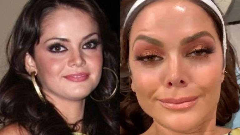 Antes y después de Marisol González