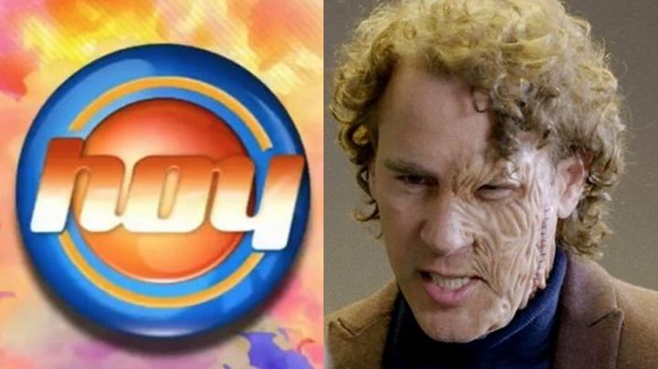 Tras acabar desfigurado y renunciar a Televisa, villano deja las novelas y reaparece en 'Hoy'