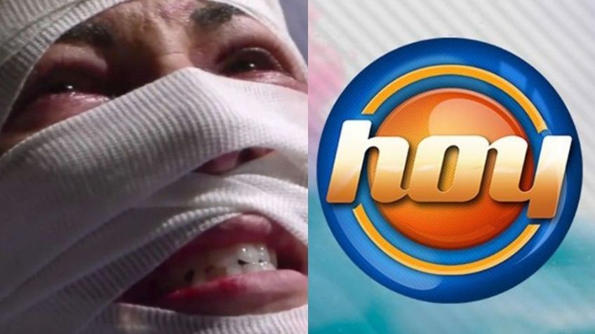 Desfigurada y sin dinero: Tras 18 años retirada de Televisa y veto de TV Azteca, actriz llega a 'Hoy'