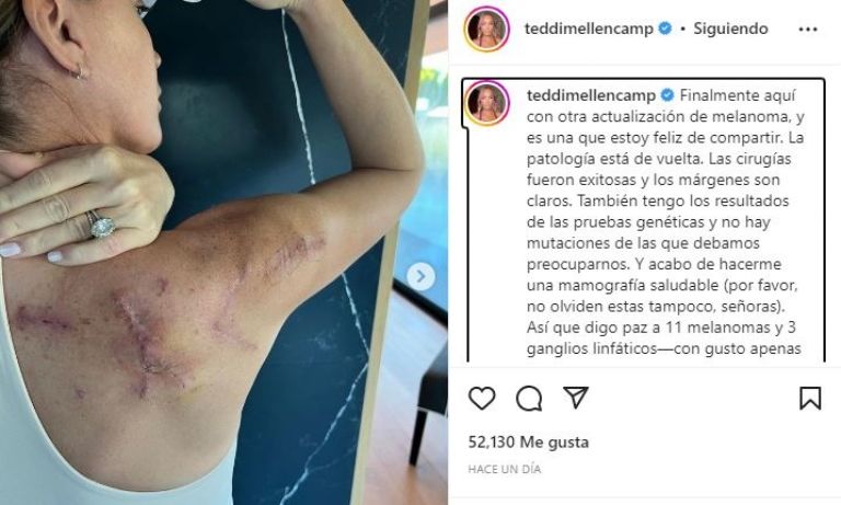 Publicación de Teddi Mellencamp