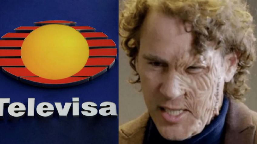 Tras 'desfigurarse', villano de Televisa abandona México y se retira de las novelas para hacer esto