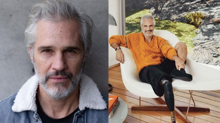 "Gané más de lo que perdí": Juan Pablo Medina habla tras amputación de pierna y muestra su prótesis