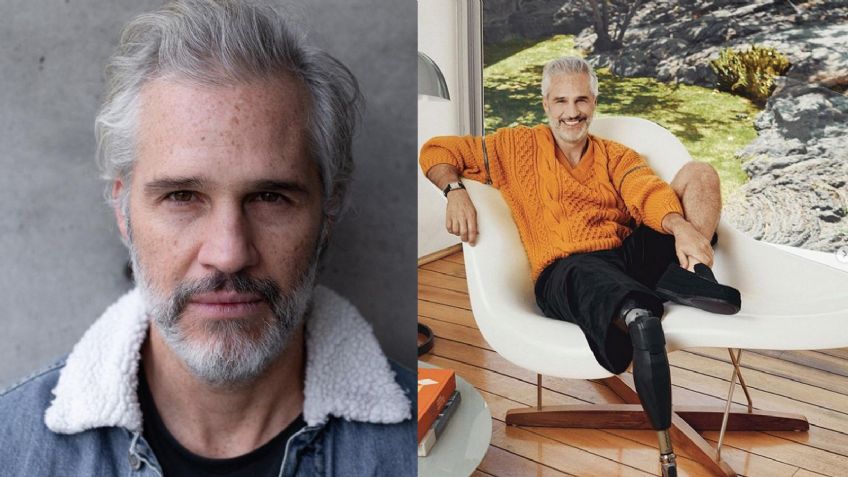 "Gané más de lo que perdí": Juan Pablo Medina habla tras amputación de pierna y muestra su prótesis