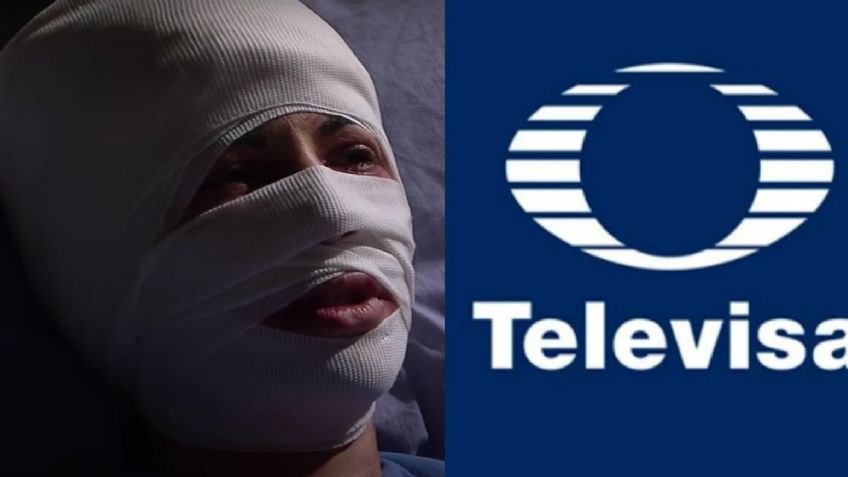 Desfigurada y sin un peso: Tras 18 años retirada y veto de TV Azteca, actriz 'vuelve' a Televisa