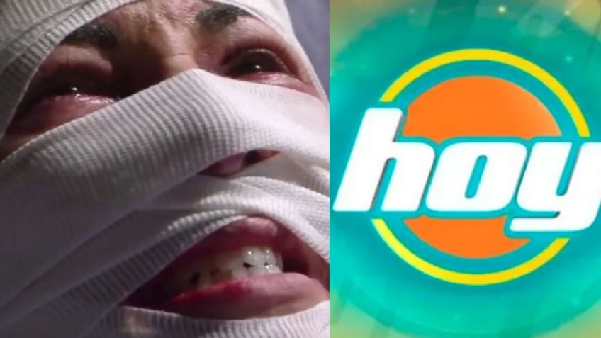Tras 18 años retirada de Televisa y veto de TV Azteca, actriz llega a 'Hoy' desfigurada y sin un peso