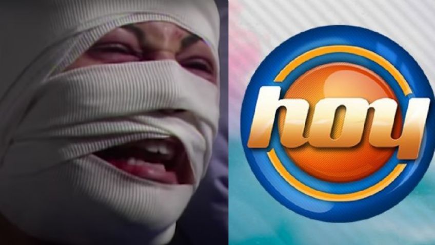 Desfigurada y en la ruina: Tras 18 años retirada de Televisa, exvillana de TV Azteca llega a 'Hoy'