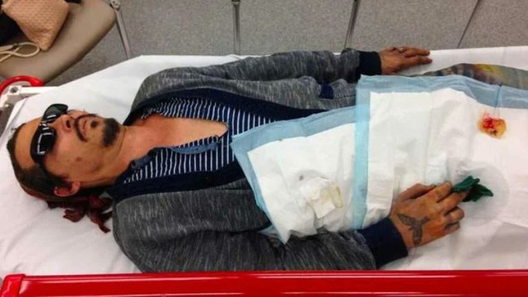 En la imagen, una de las fotografías que se filtraron tras el 'incidente' del dedo de Johnny Depp