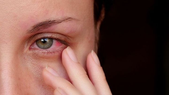 ¿Tienen relación? Estudio señala presencia de derrame en ojos como secuela de Covid-19