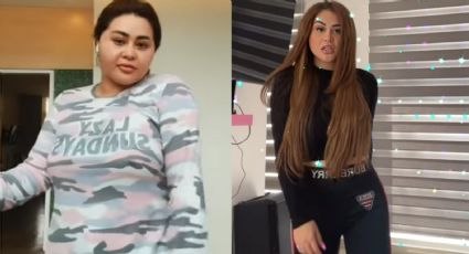 'Gomita' impacta en Instagram y la destrozan tras bajar 13 kilos con cirugía: "¿La cara pa' cuándo?"