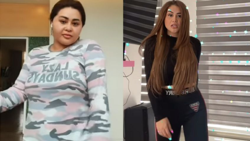 'Gomita' impacta en Instagram y la destrozan tras bajar 13 kilos con cirugía: "¿La cara pa' cuándo?"