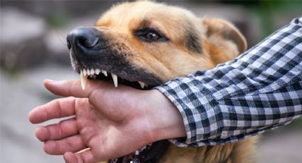 Nogales: Perro ataca a mujer en la colonia Bella Vista y termina en el hospital