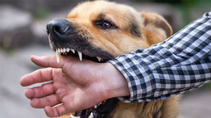 Nogales: Perro ataca a mujer en la colonia Bella Vista y termina en el hospital