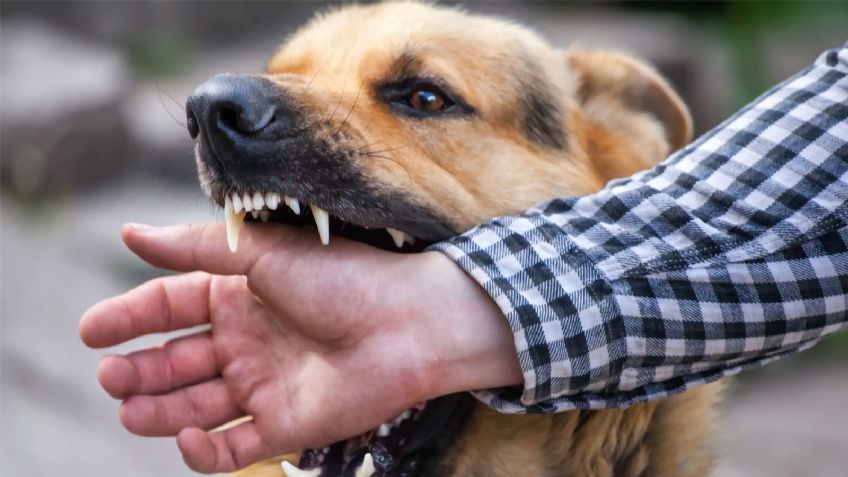 Nogales: Perro ataca a mujer en la colonia Bella Vista y termina en el hospital