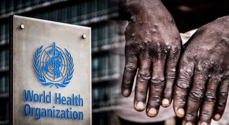 OMS advierte por más casos de viruela del mono en el mundo 