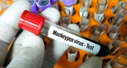 SSA confirma segundo caso de viruela del mono en la CDMX; el paciente se reporta estable