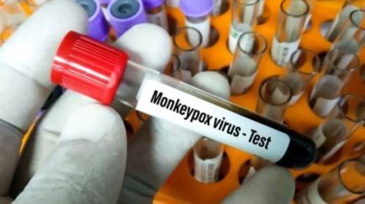 SSA confirma segundo caso de viruela del mono en la CDMX; el paciente se reporta estable