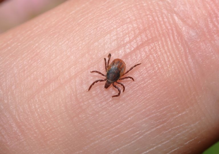 Menor fallece tras severa crisis de piojos