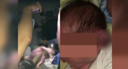 Tras quedarse sin luz en hospital, realizan cesárea con celulares; le cortaron la oreja al bebé