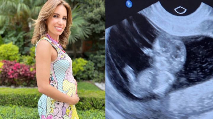 Andrea Escalona impacta a Televisa al anunciar embarazo y esto se sabe sobre el padre de su bebé