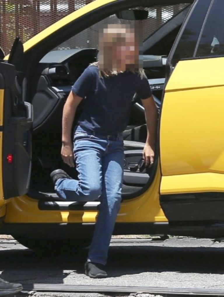 En la imagen, Samuel Garner Affleck, tras el accidente vehicular. Foto: TMZ
