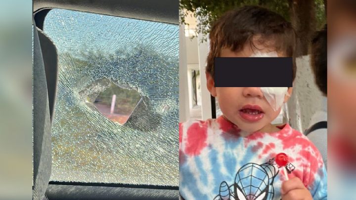 "El niño casi pierde un ojo", Denuncian agresión en ‘retén’ en Las Guásimas, Sonora