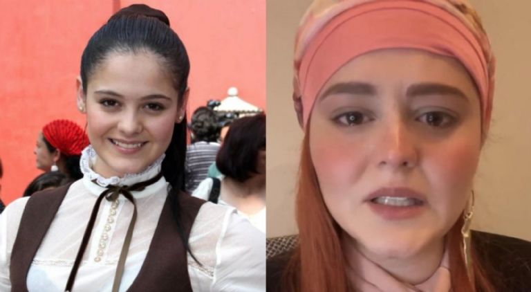 El antes y después de Allisson Lozz