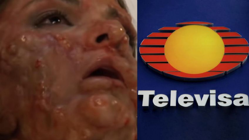 Se desfiguró: Tras perder exclusividad en Televisa, ejecutivos corren y vetan a villana de novelas