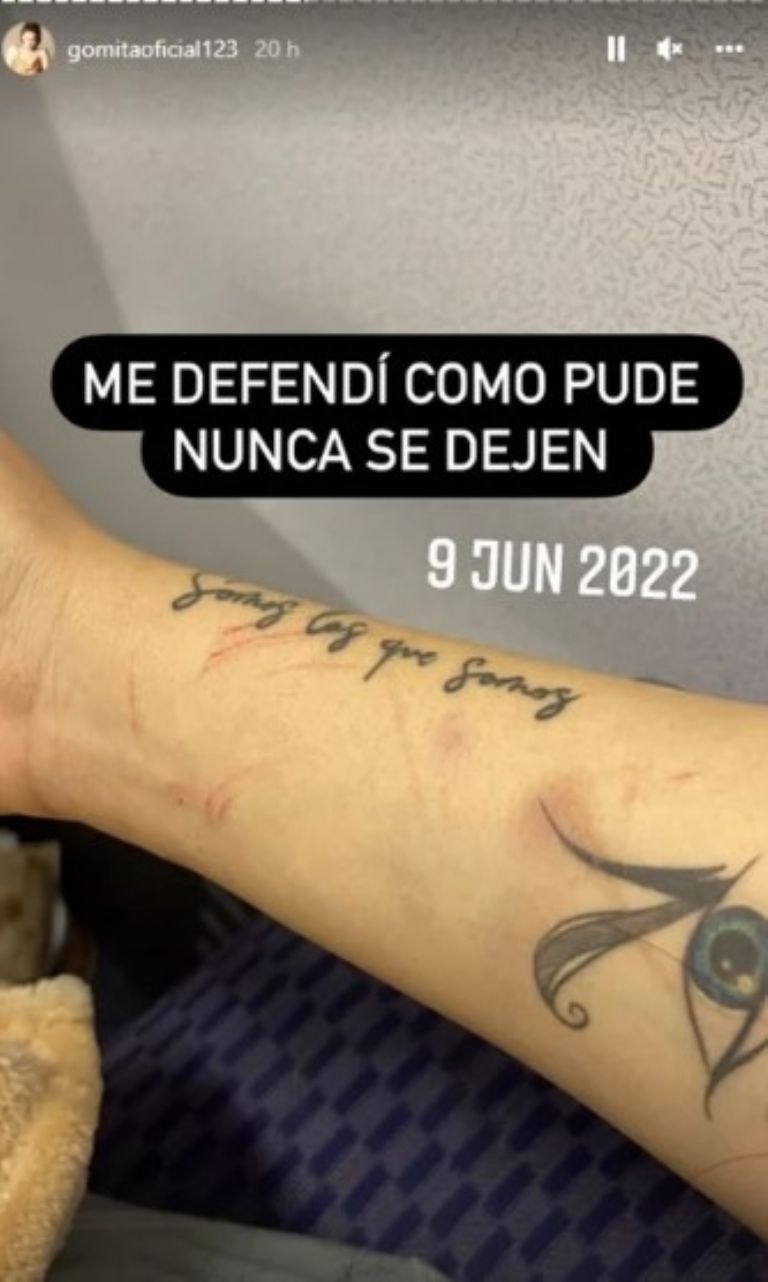 Las lesiones que mostró Araceli Ordaz