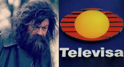 Acabó de indigente y desfigurado: Tras renunciar a TV Azteca, villano de novelas vuelve a Televisa