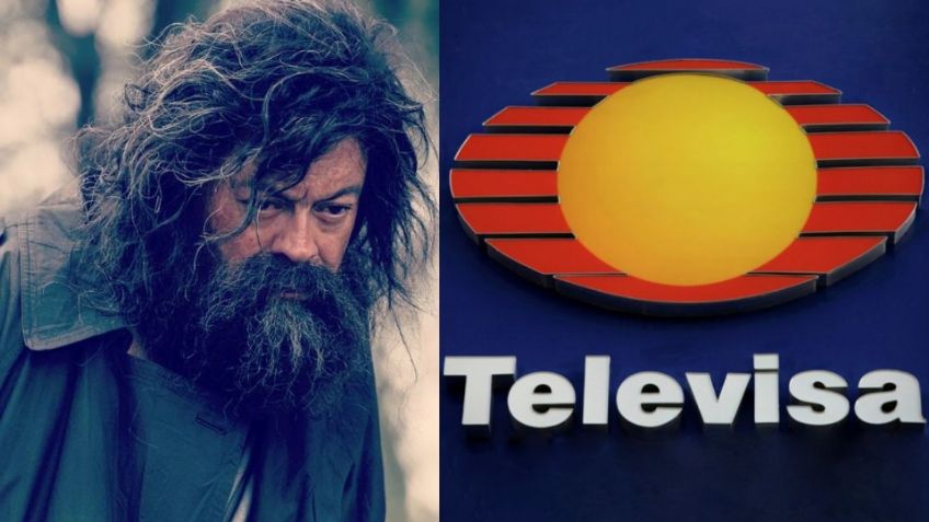 Acabó de indigente y desfigurado: Tras renunciar a TV Azteca, villano de novelas vuelve a Televisa