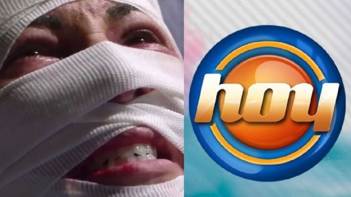 Desfigurada y en la ruina: Tras 18 años retirada de Televisa, exactriz de TV Azteca llega a 'Hoy'